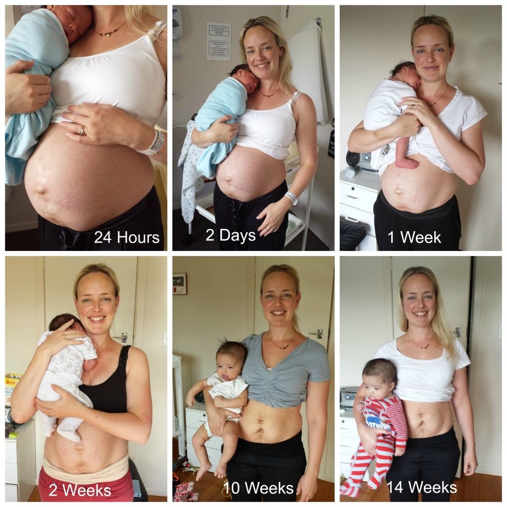 Pregnancy Recovery Products - Waist Me Up
